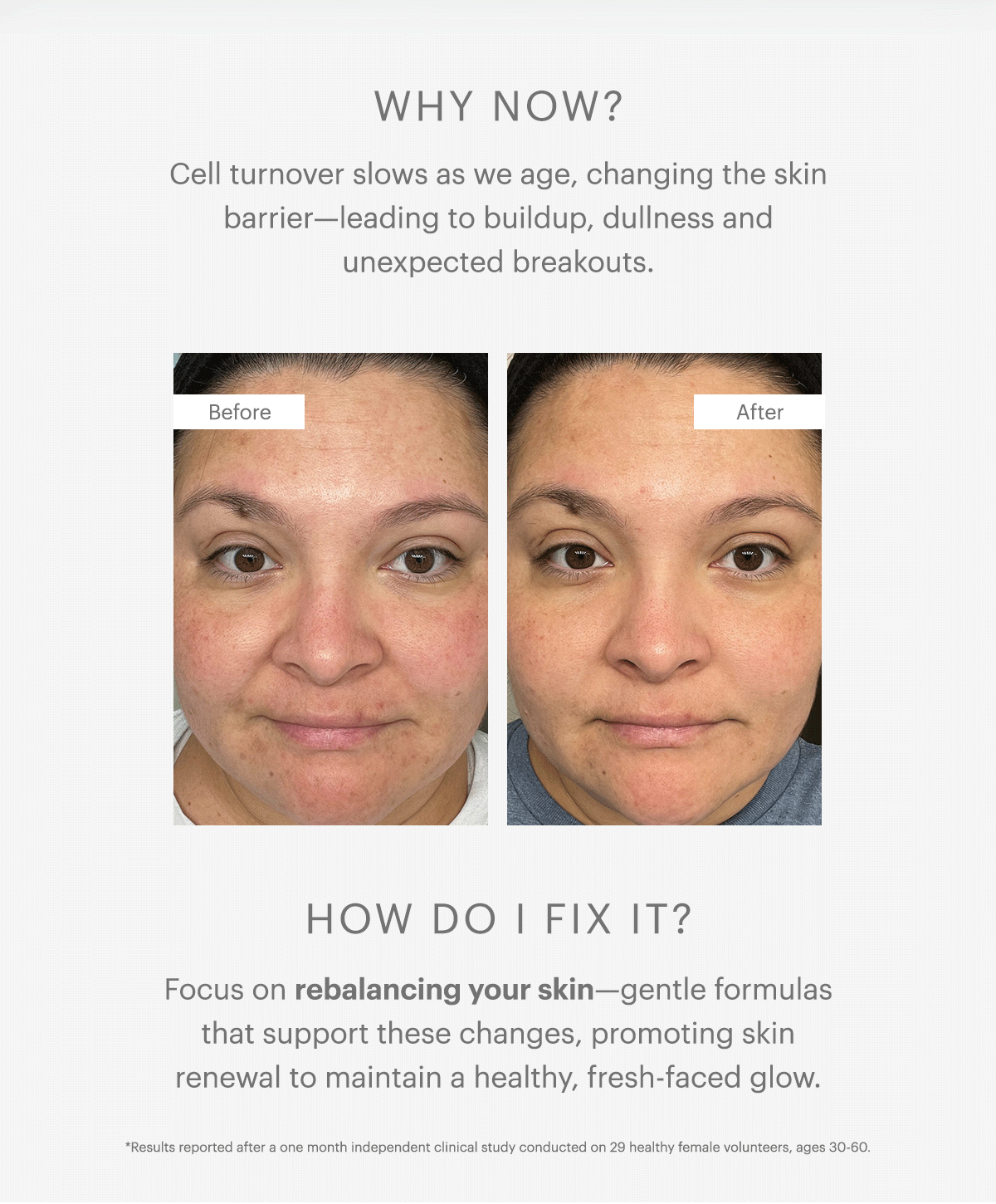 WHY NOW? Cell turnover slows as we age, changing the skin barrier—leading to buildup, dullness and unexpected breakouts.