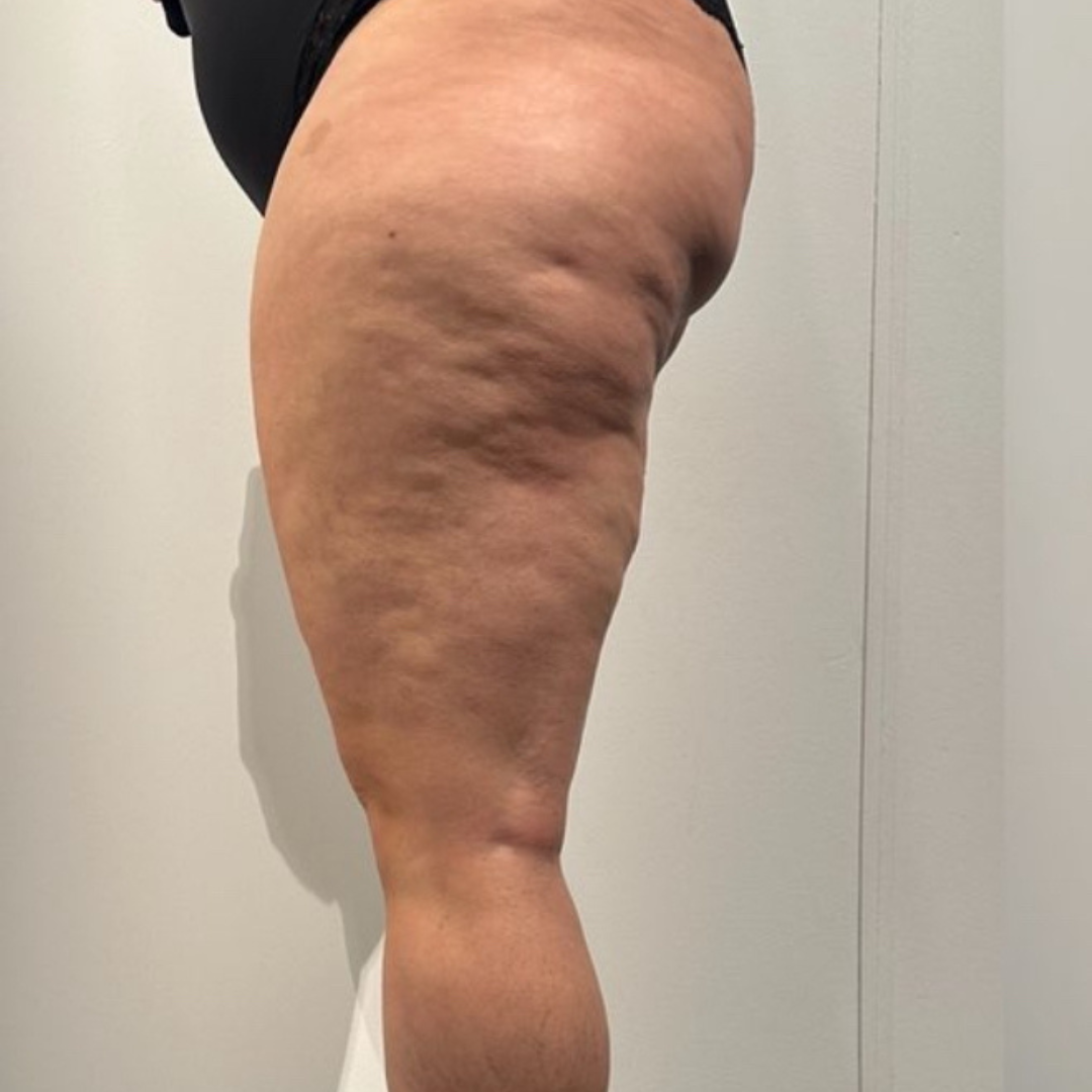 Day 1