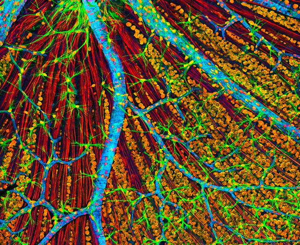 An artificially coloured confocal light micrograph of the retina, showing blue branching blood vessels, green glial cells and clusters of orange ganglion cells over red optic-nerve fibres