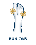 Shoes for Bunions