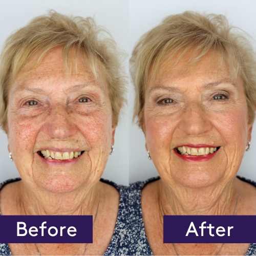 Find out how to cover under-eye bags instantly. Reduce the appearance of puffiness and achieve a refreshed look