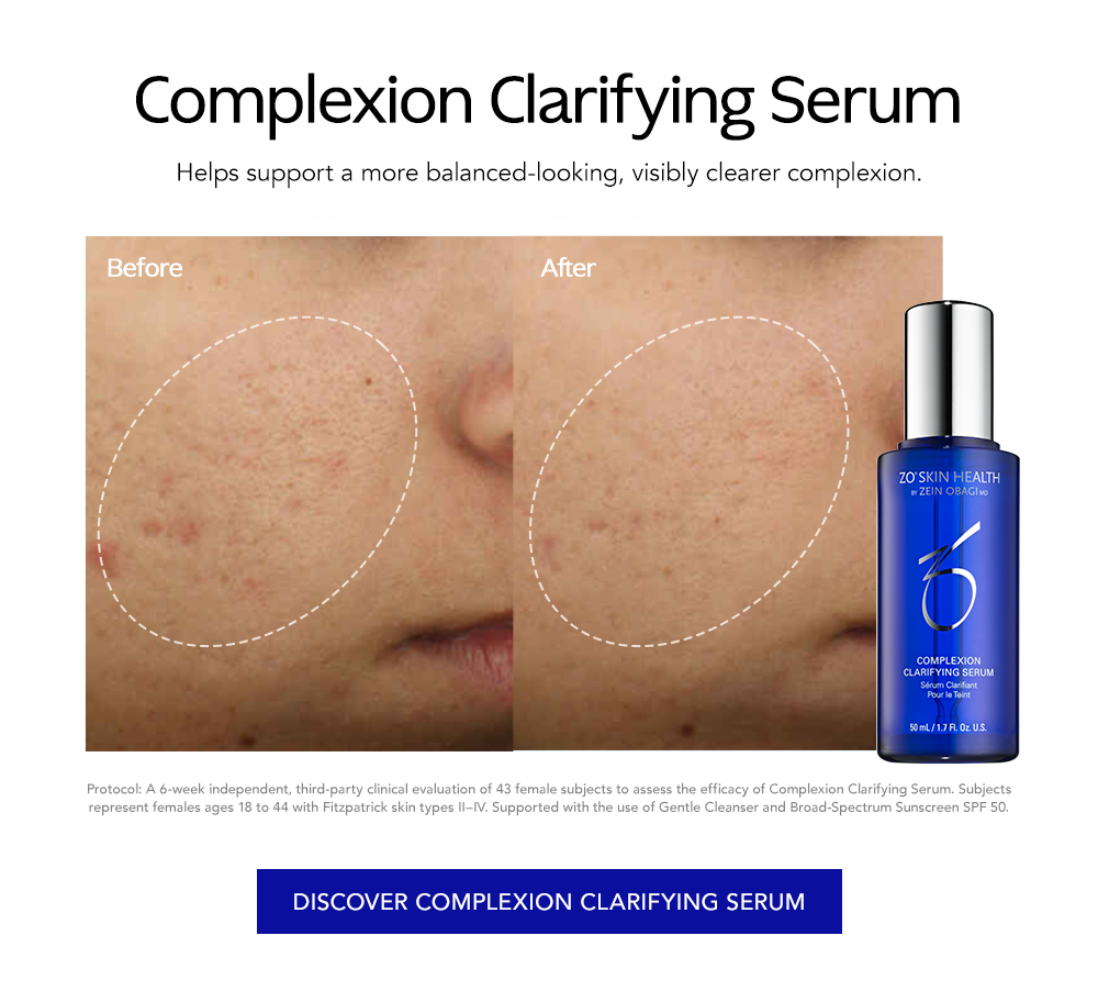 Complexion Clarifying Serum