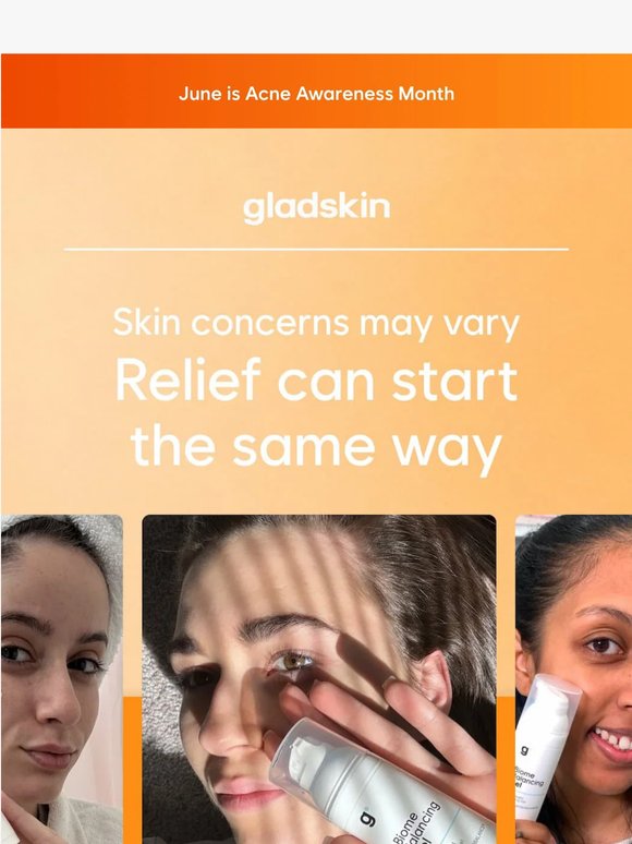 Real relief for flareups, redness, and breakouts
