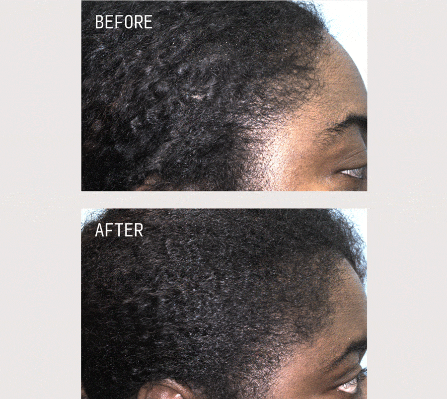 Before and After Images