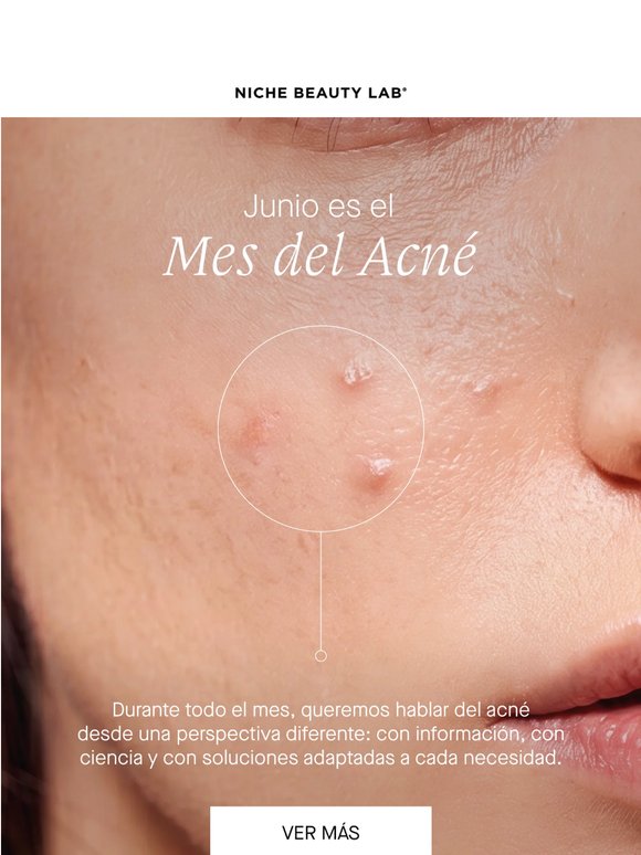 Junio es el Mes del Acné 💛 Una solución Acnemy para cada necesidad de tu piel