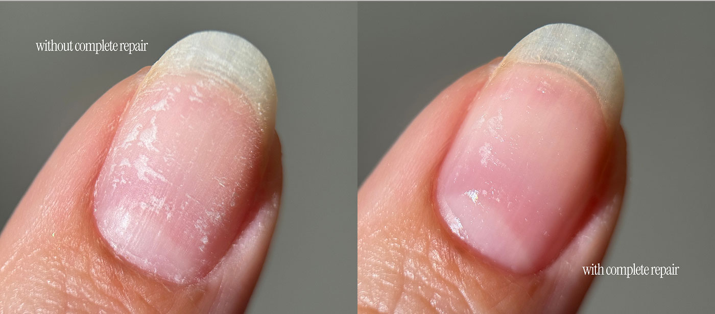 MEET  Complete Repair  AFTER-GEL RECOVERY  A targeted recovery treatment designed to help restore nails after gel, acrylic, or removal damage. This lightly violet-tinted formula helps support nail strength, improve the look of weakened nails, and leave nails looking smoother, healthier, and more resilient over time.  HERO INGREDIENTS  NEONYCA A plant-derived celery seed extract that helps improve nail thickness, smoothness, cohesion, and hydration — ideal for nails weakened after gel wear.  NAIL HERO COMPLEX A strengthening complex that helps reduce brittleness while supporting stronger, healthier-looking nails over time. 