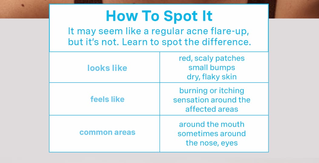 How To Spot It | It may seem like a regular acne flare-up, but it's not. Learn to spot the difference.