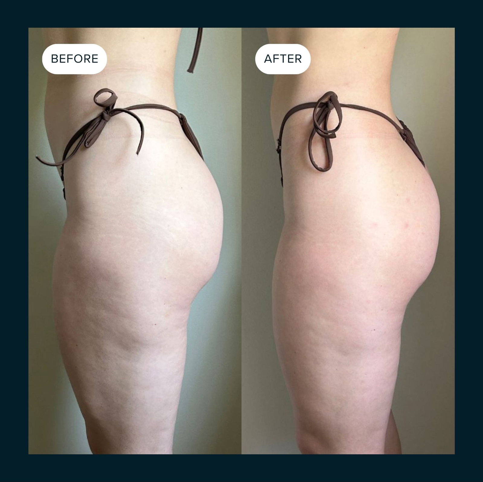 Before and After