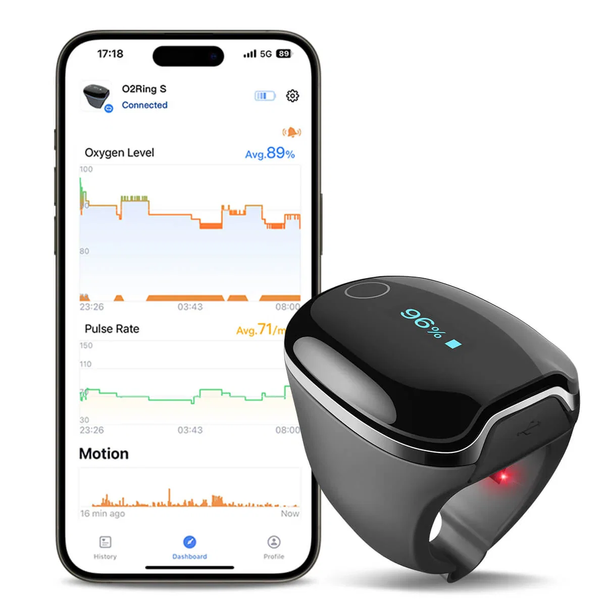 O2RIng-S with app data