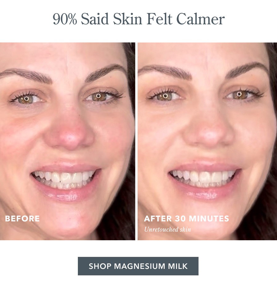 90% Said Skin Felt Calmer | SHOP MAGNESIUM MILK