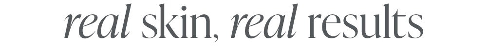 real skin, real results 