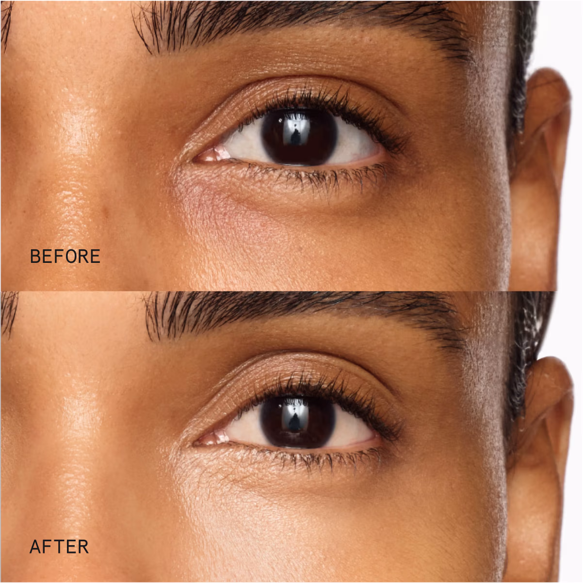 Before & After using Superluminous Under-Eye Genius