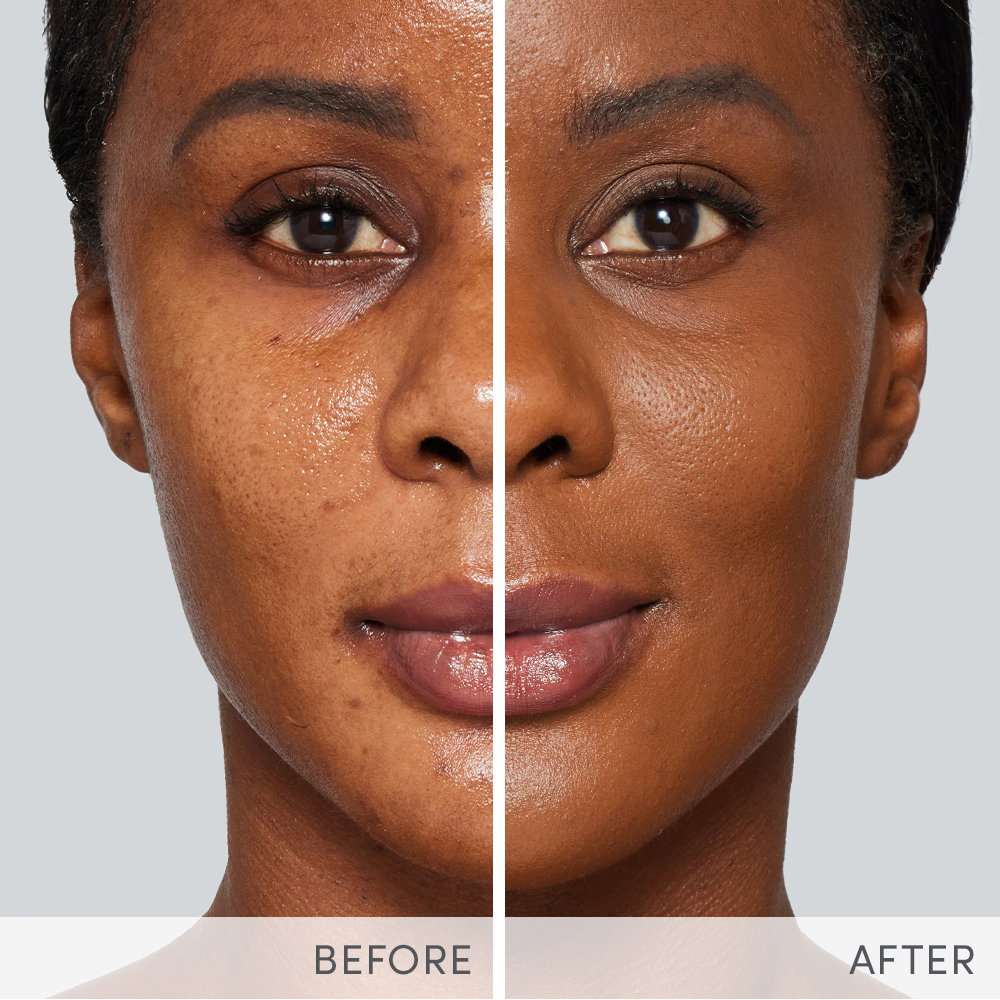 Before & After Image