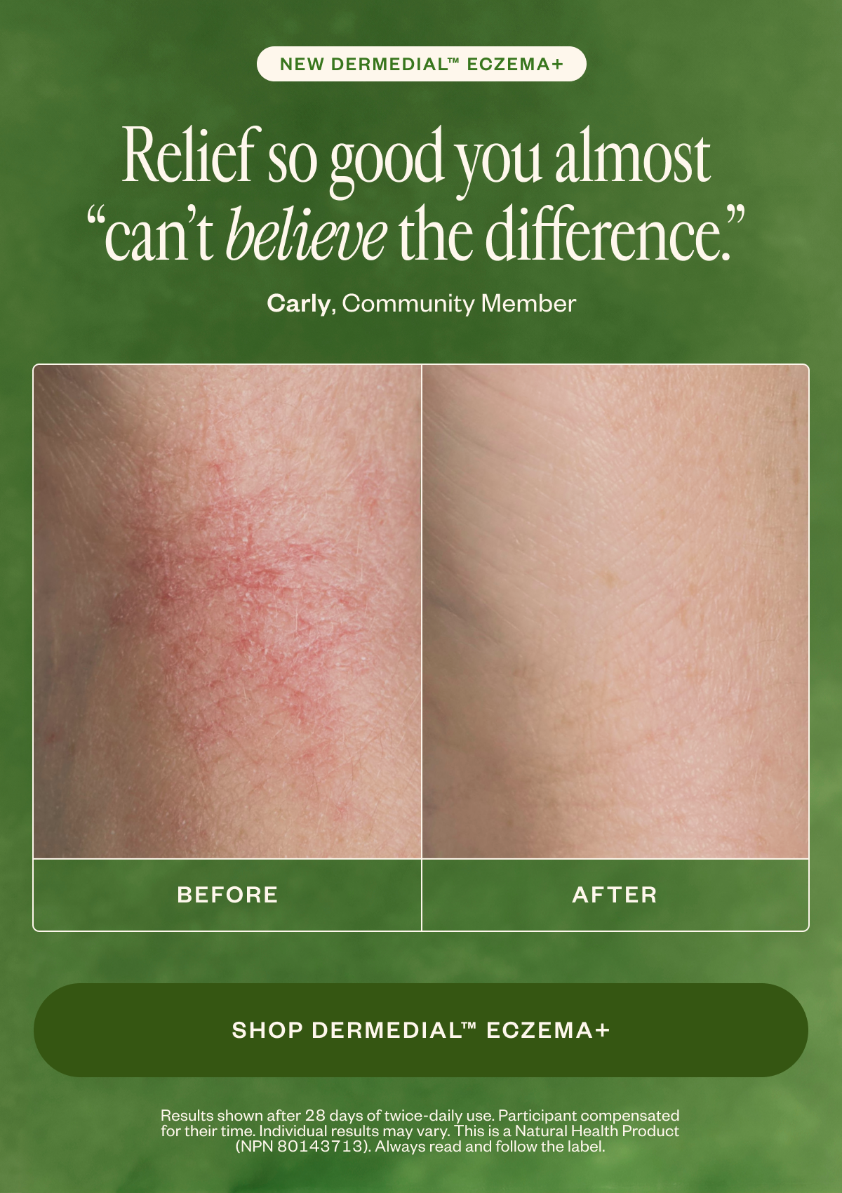 Relief so good you almost "can't believe the difference"