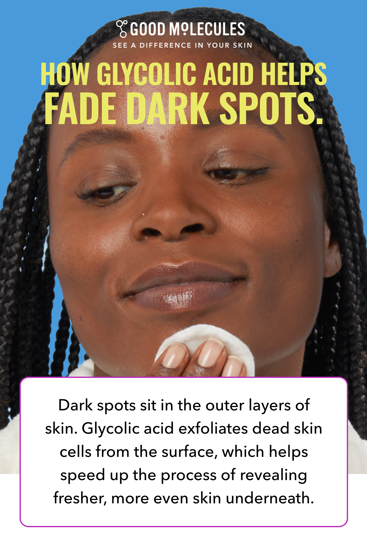 How glycolic acid helps fade dark spots