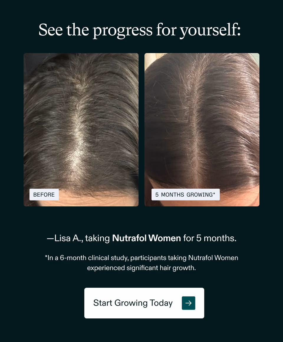 See the progress for yourself: Lisa A., taking Nutrafol Women for 5 months. *In a 6-month clinical study, participants taking Nutrafol Women experienced significant hair growth. Start Growing Today
