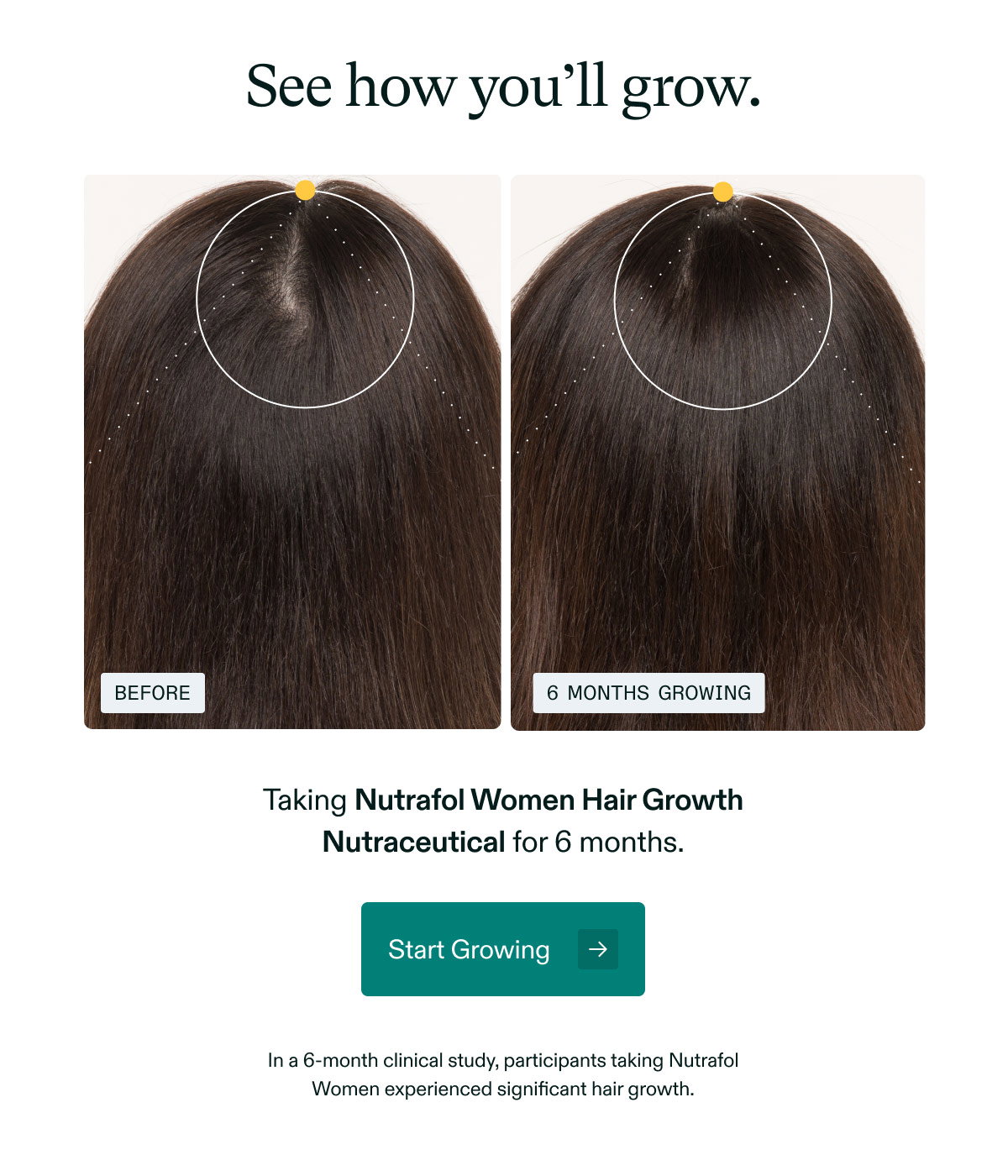 See how you’ll grow. Taking Nutrafol Women Hair Growth Nutraceutical for 6 months.  Start Growing →  In a 6-month clinical study, participants taking Nutrafol Women experienced significant hair growth.