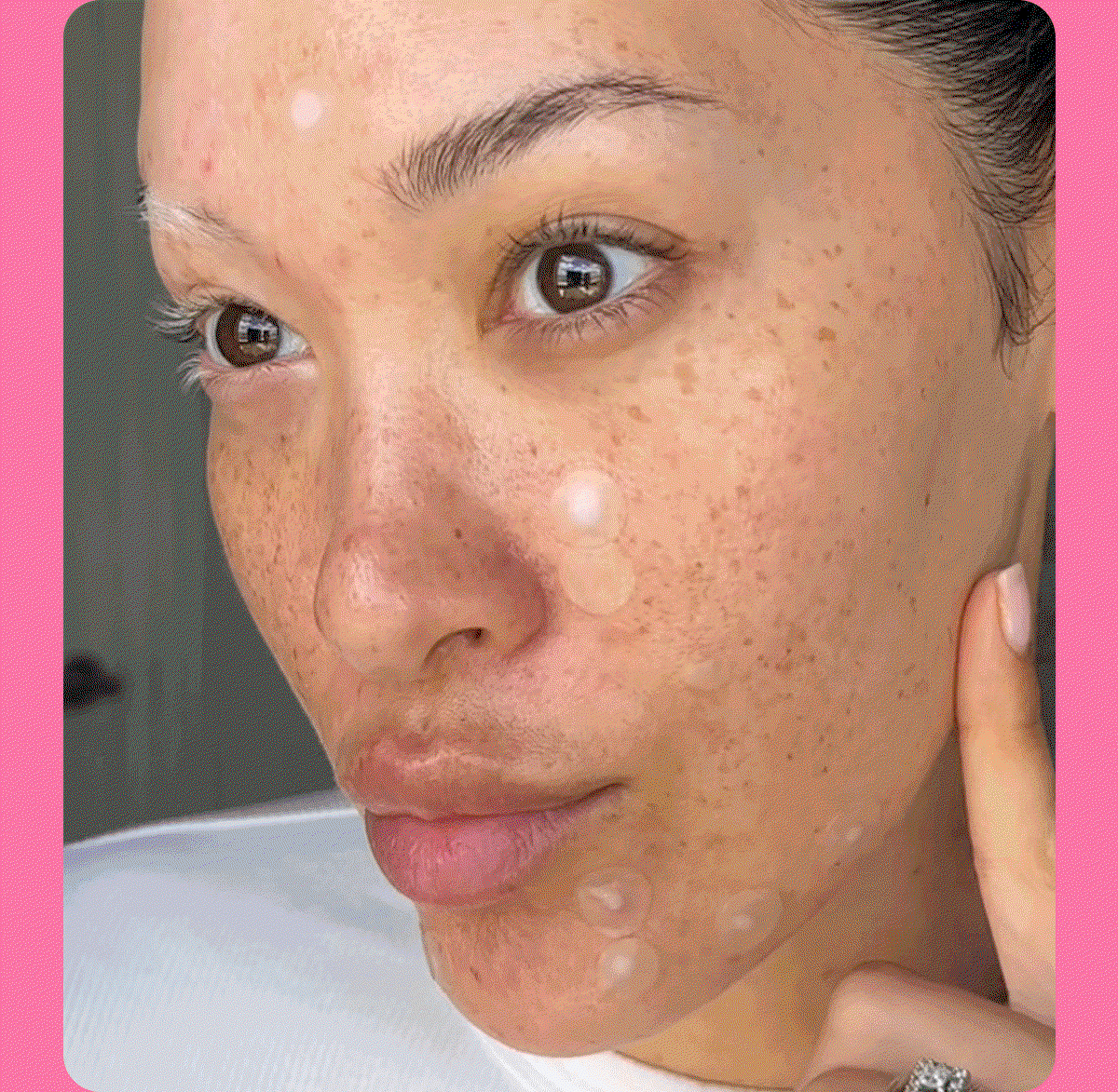 Shop Spot Treatments