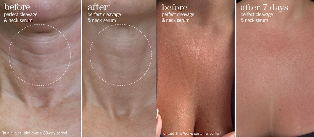 perfect-cleavage-neck-serum