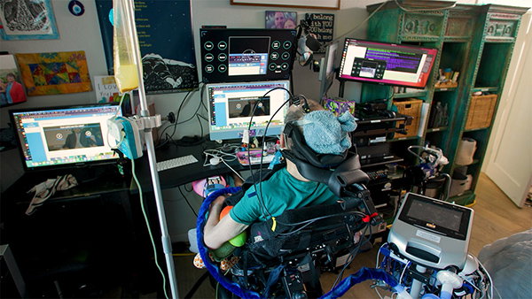 Casey Harrell using the brain–computer interface at his home. He is seated in his wheelchair and two wires can be seen attached to his head.