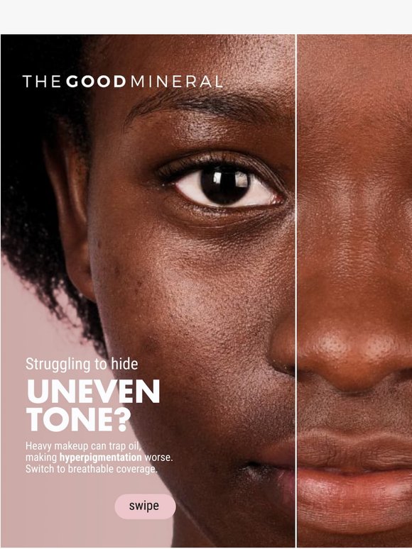 Still trying to hide uneven tone?