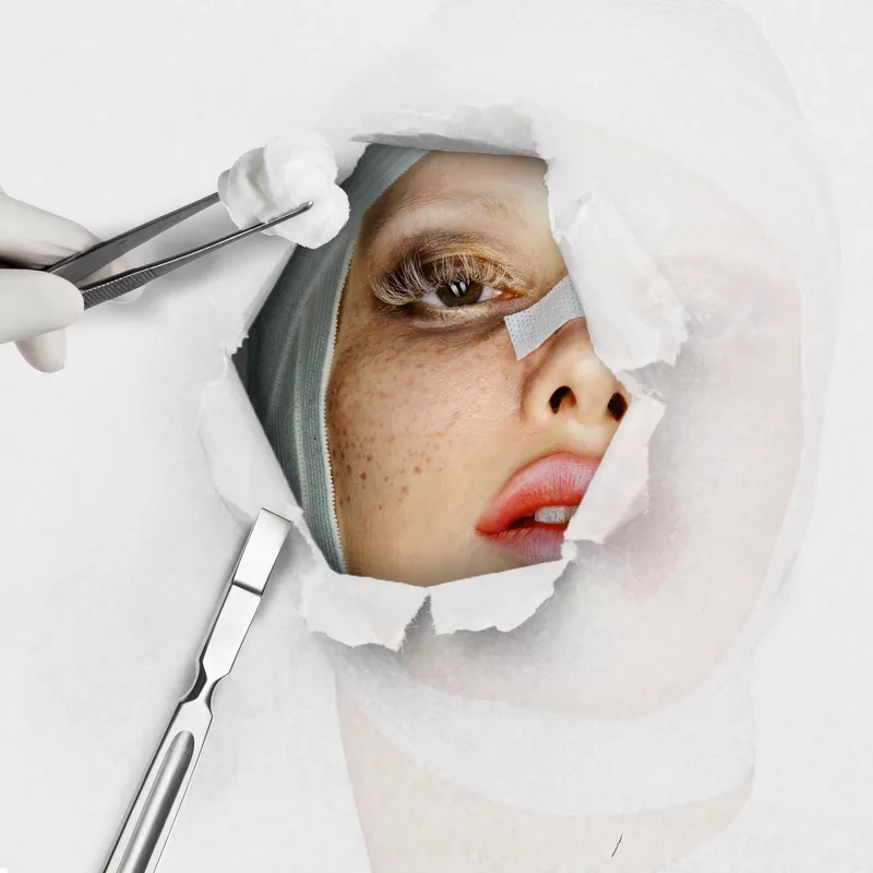 I Spent a Week As My Friend’s Facelift Nurse. Here’s What No One Tells You.