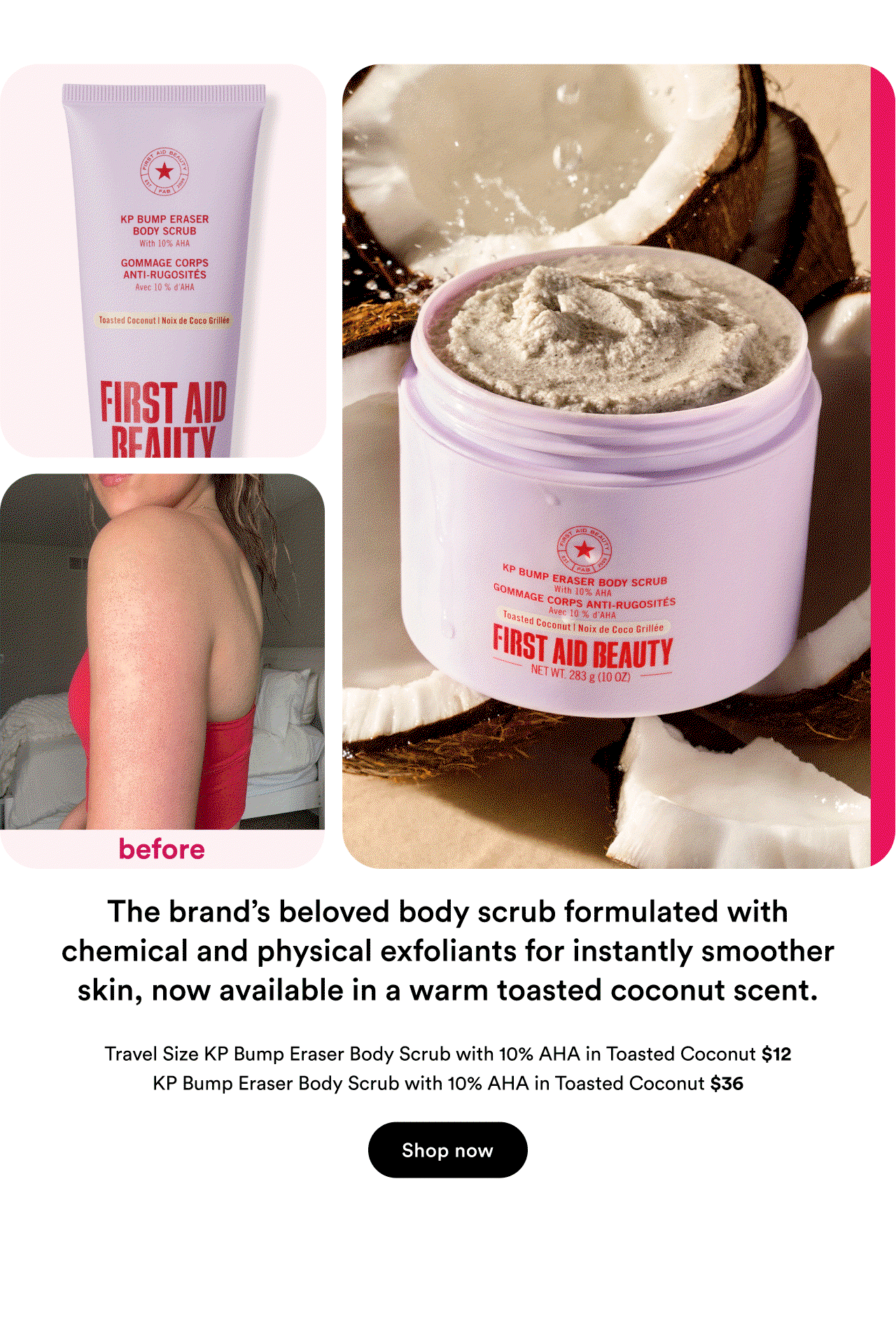 Travel size KP bump eraser body scrub | KP bump eraser body scrub | Shop now