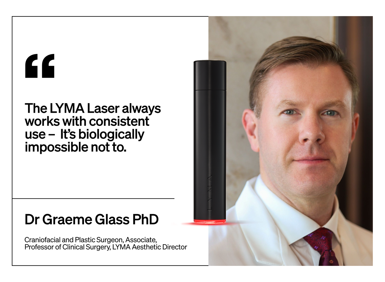 Shop the LYMA Laser