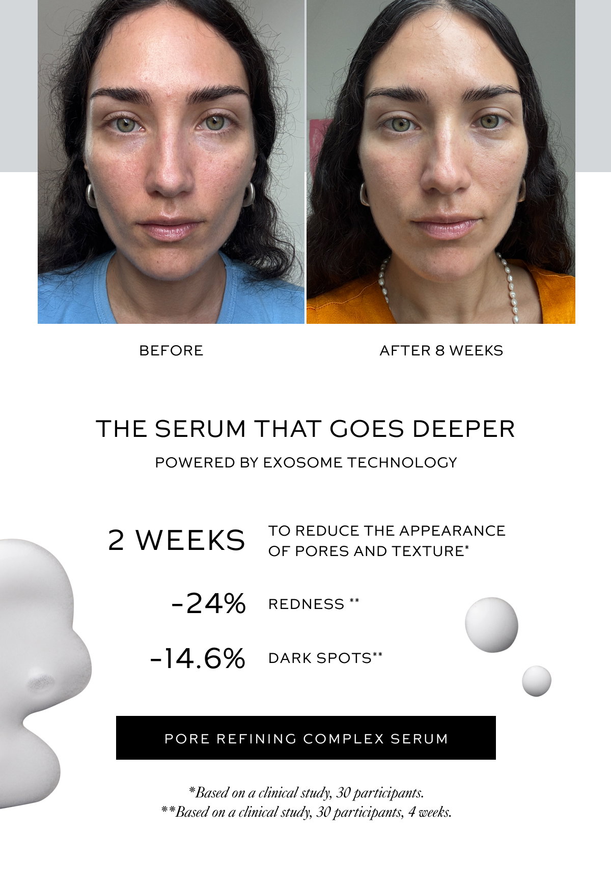 Pore Refining Complex Serum