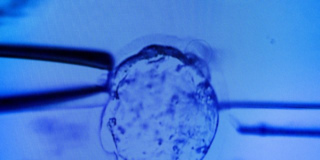 FIV : en Floride, ils élèvent un bébé