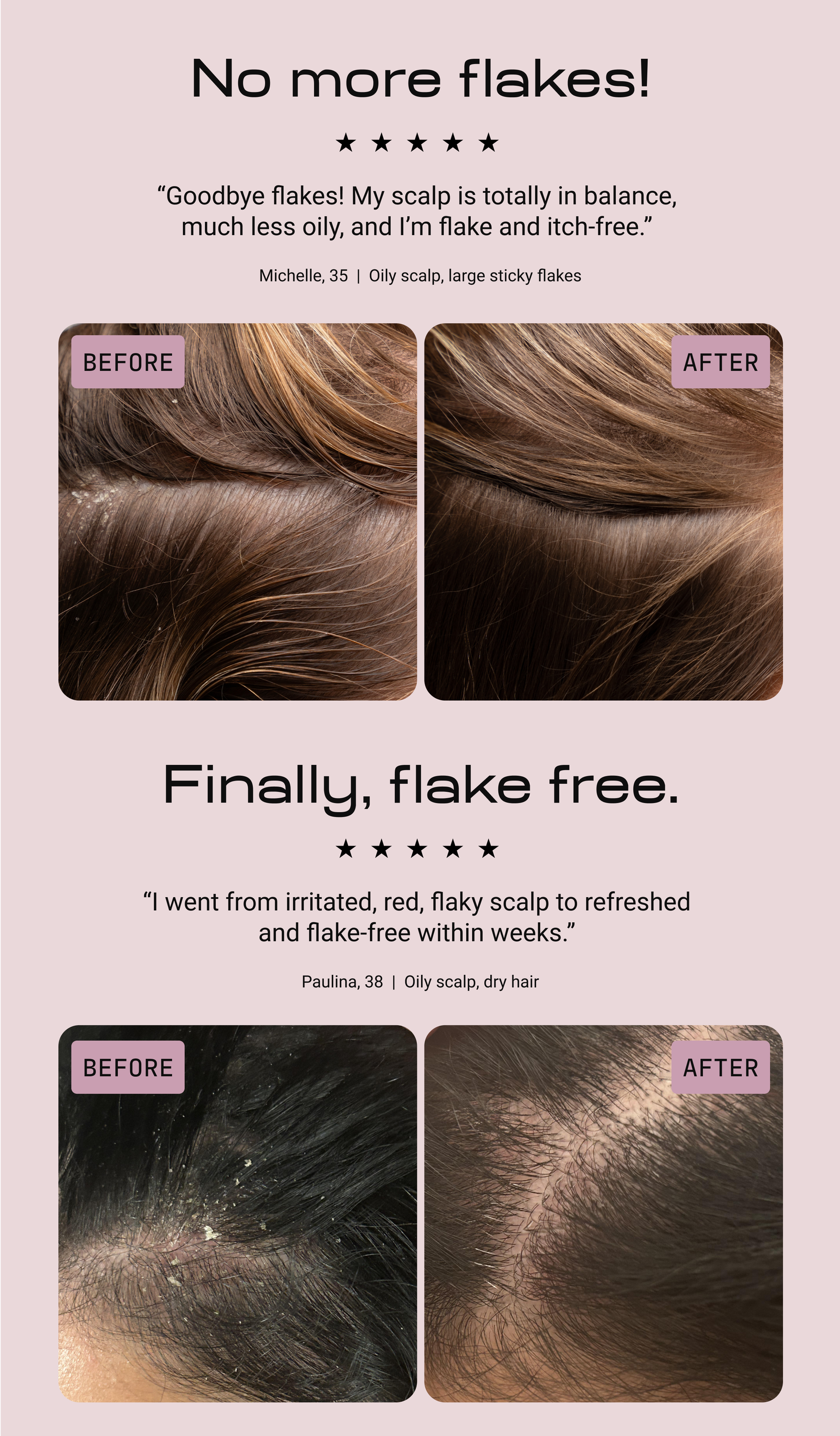 Two five-star customer before-and-after scalp photos. First, headline No more flakes, with Michelle, 35: Goodbye flakes, my scalp is totally in balance, much less oily, and I'm flake and itch-free. Second, headline Finally, flake free, with Paulina, 38: I went from irritated, red, flaky scalp to refreshed and flake-free within weeks. Both show clearer, flake-free scalps in the after photos.