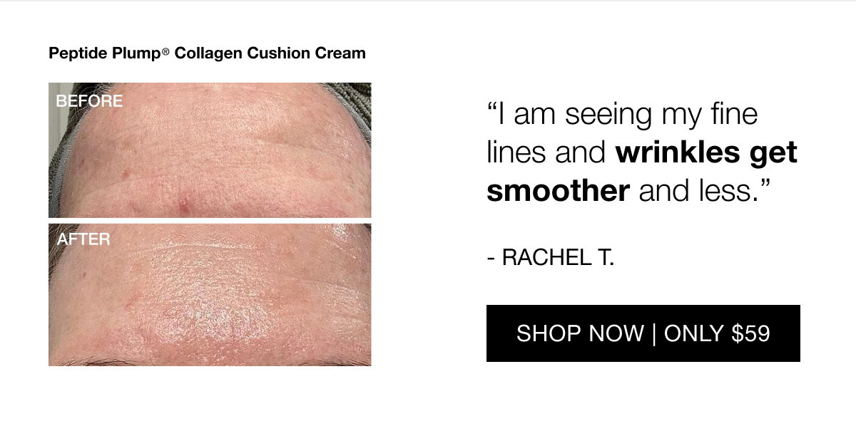 The next-gen wrinkle cream