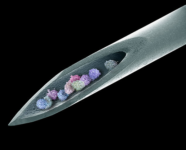 Composite coloured scanning electron micrograph of a needle with bone marrow cells inside.