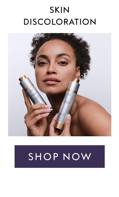 Skin Discoloration