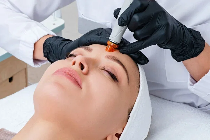 Hydrafacial med eller utan naturlig kemisk peeling på Kungsholmen