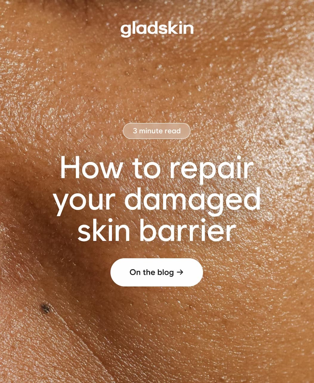 How to repair your damaged skin barrier  CTA: On the blog →