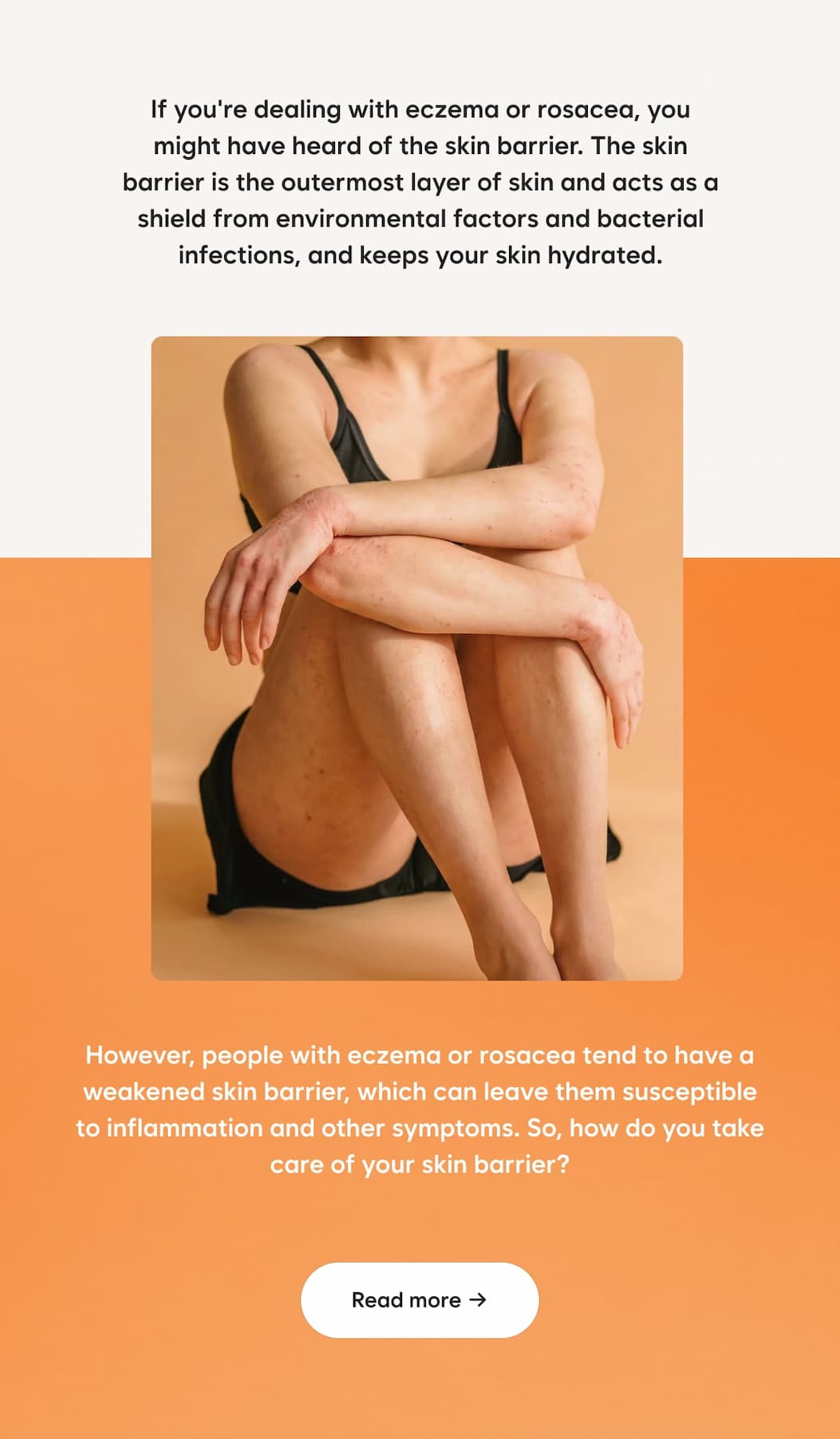 If you're dealing with eczema or rosacea, you might have heard of the skin barrier. The skin barrier is the outermost layer of skin and acts as a shield from environmental factors and bacterial infections, and keeps your skin hydrated.  However, people with eczema or rosacea tend to have a weakened skin barrier, which can leave them susceptible to inflammation and other symptoms. The good news? With the right approach, you can help support and strengthen your skin barrier over time.  CTA: Read more →