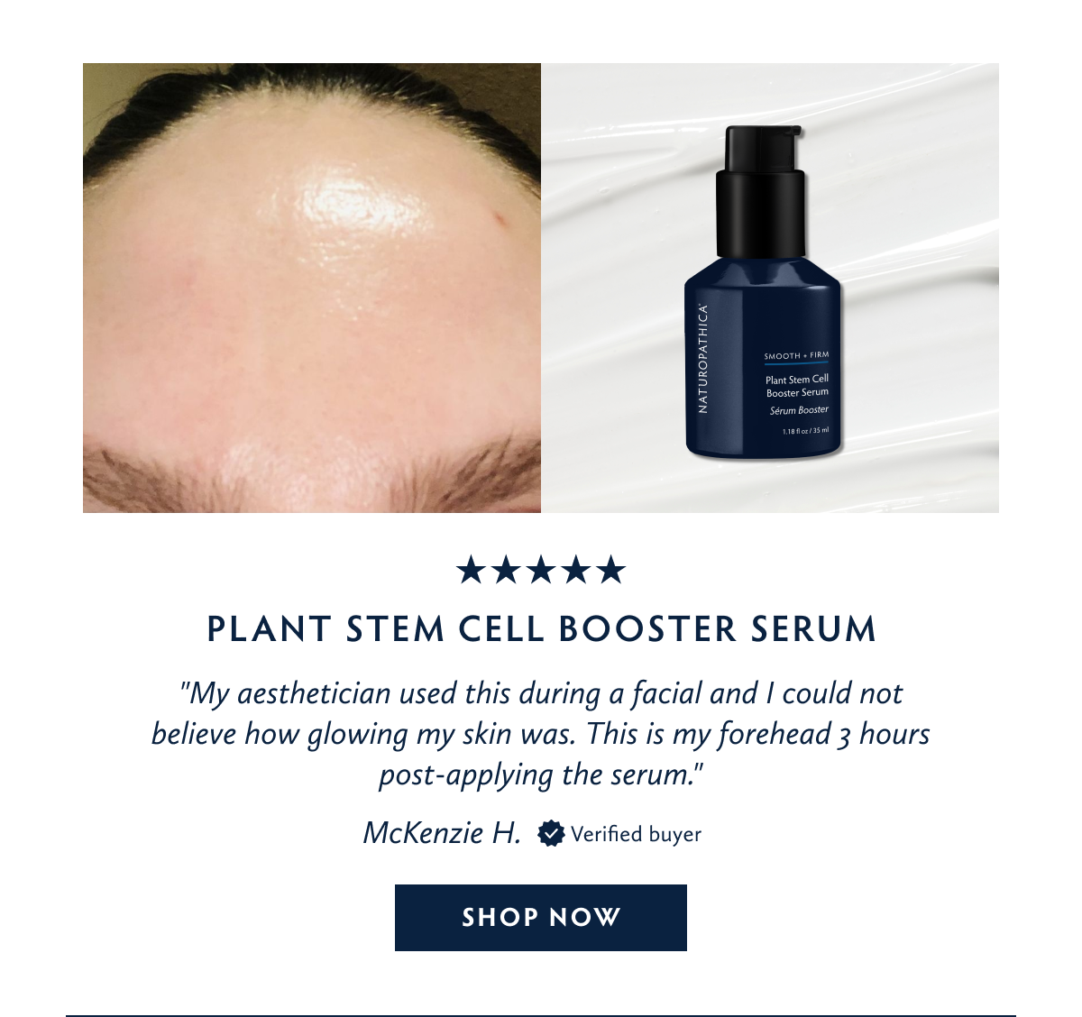 Plant Stem Cell Booster Serum