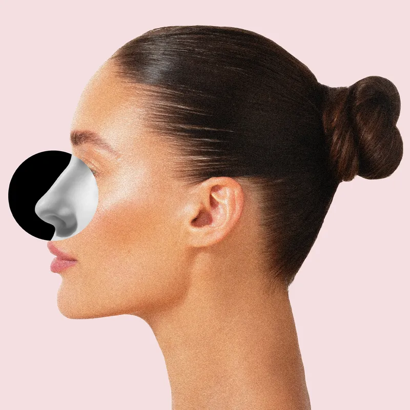 What It Took to Fix My Nose Job