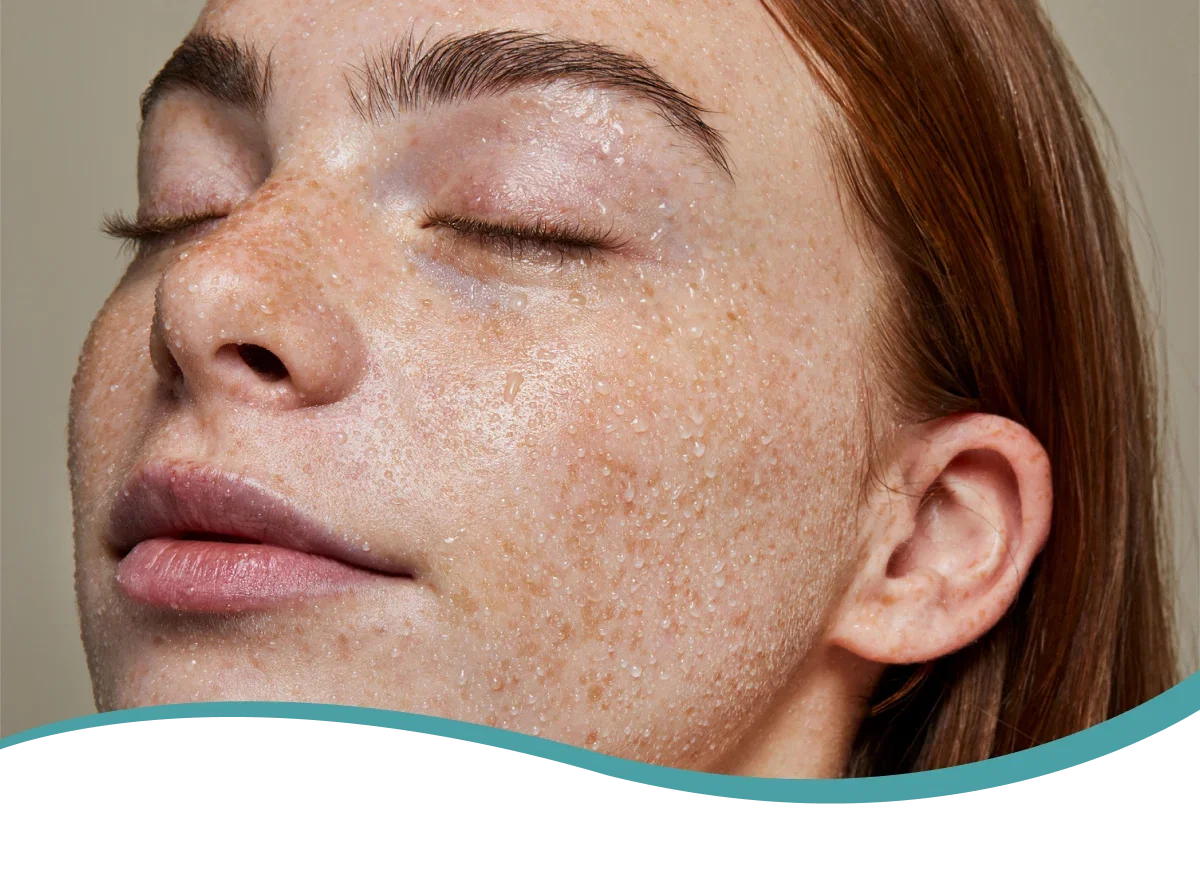 An image of a model using the banana split eye mask
