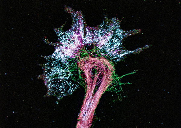 Light micrograph of a nerve cell that has been prepared with expansion microscopy.