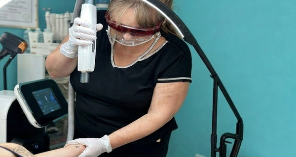 One Laser Tattoo Removal Treatment Session for Up to 7 or 12 Sq Inches