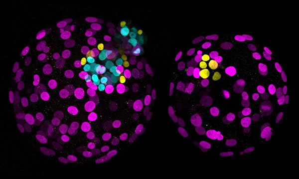A human embryo ‘base edited’ so that it can’t produce a key protein (right), fails to form the mass of cells that gives rise to tissues and organs. A non-edited embryo (left) shows the cells (cyan).