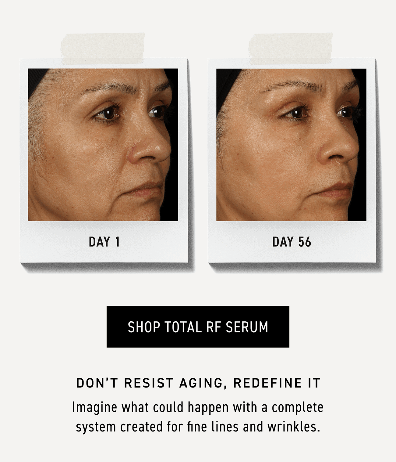 Before and after results after 56 days of using Total RF Serum. CTA: SHOP TOTAL RF SERUM