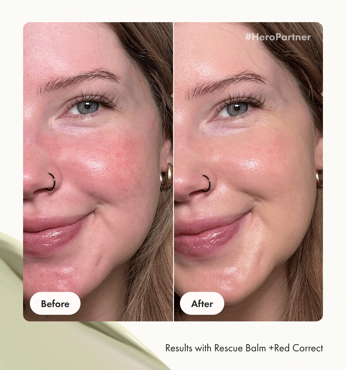 Before + After - Results with Rescue Balm +Red Correct