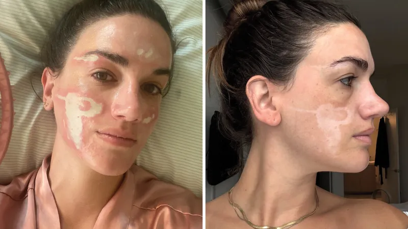 A Full Timeline of the Case Against Celebrity Aesthetician Sonya Dakar