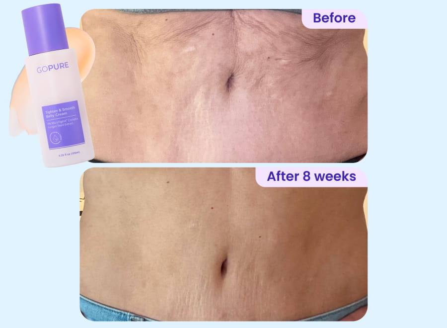 Before vs. After 8 weeks