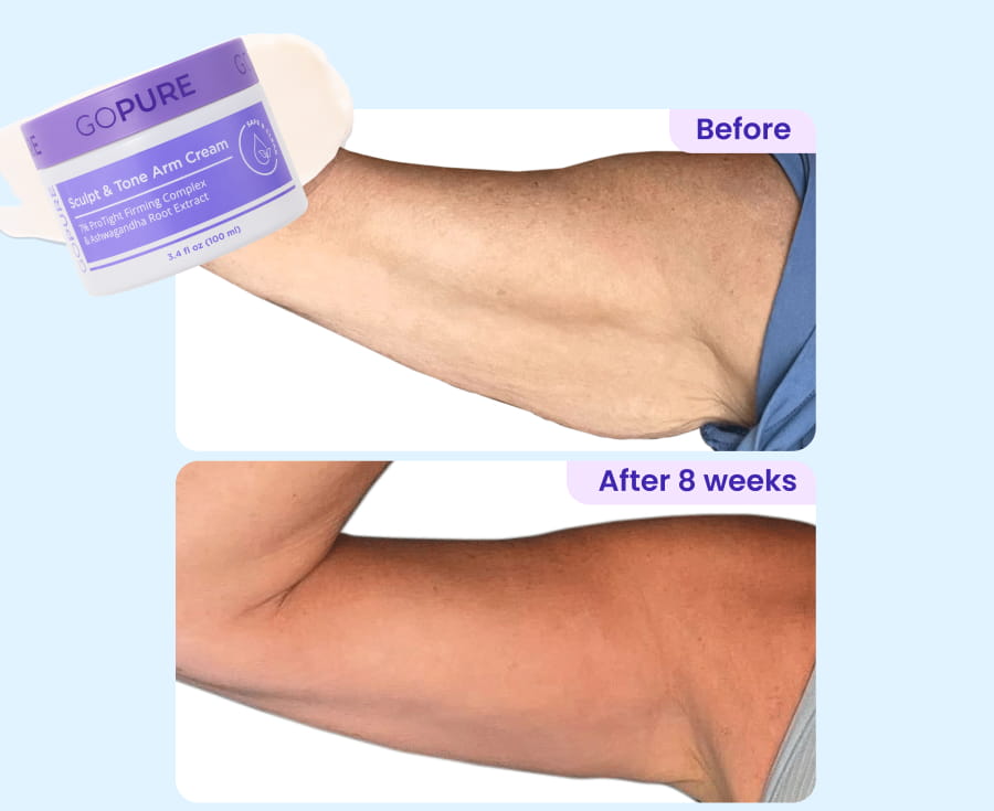 Before vs. After 8 weeks