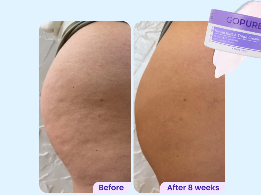 Before vs. After 8 weeks