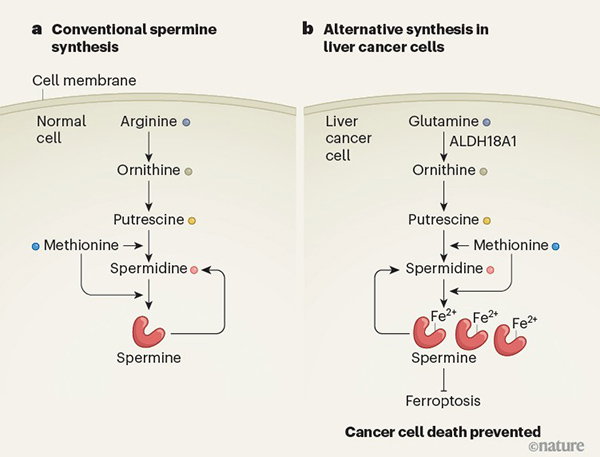 An infographic showing how a liver cancer cell prevents cell death through ferroptosis by producing spermine molecules that bind to iron. 